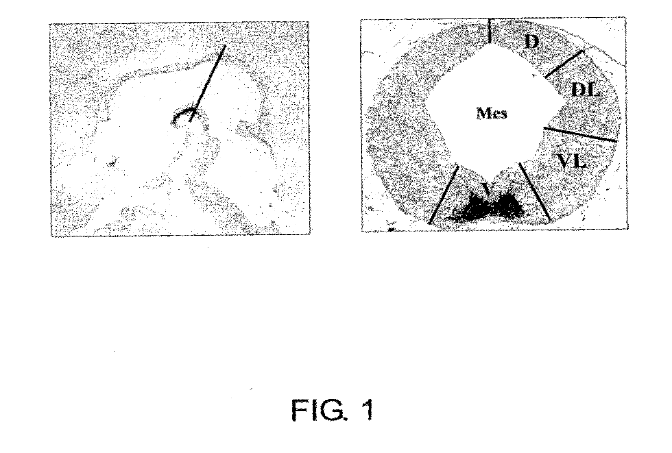 SPECIFIC MARKER Lmx1a ON DOPAMINERGIC NEURONS