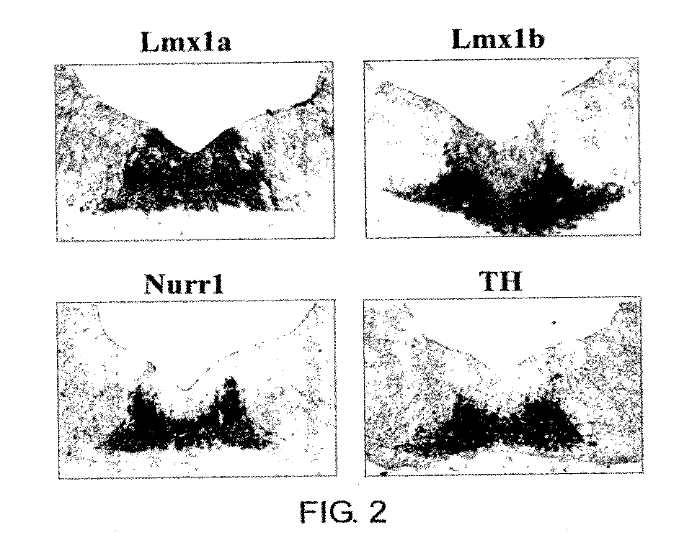 SPECIFIC MARKER Lmx1a ON DOPAMINERGIC NEURONS