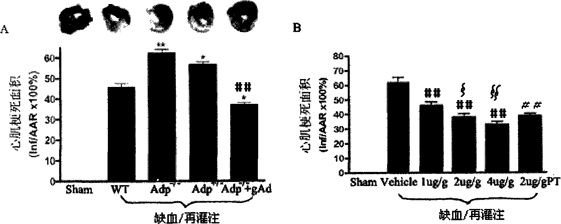 Use of human-source adiponcetin globular segment for medicine for treating diabetes and ischemic heart disease