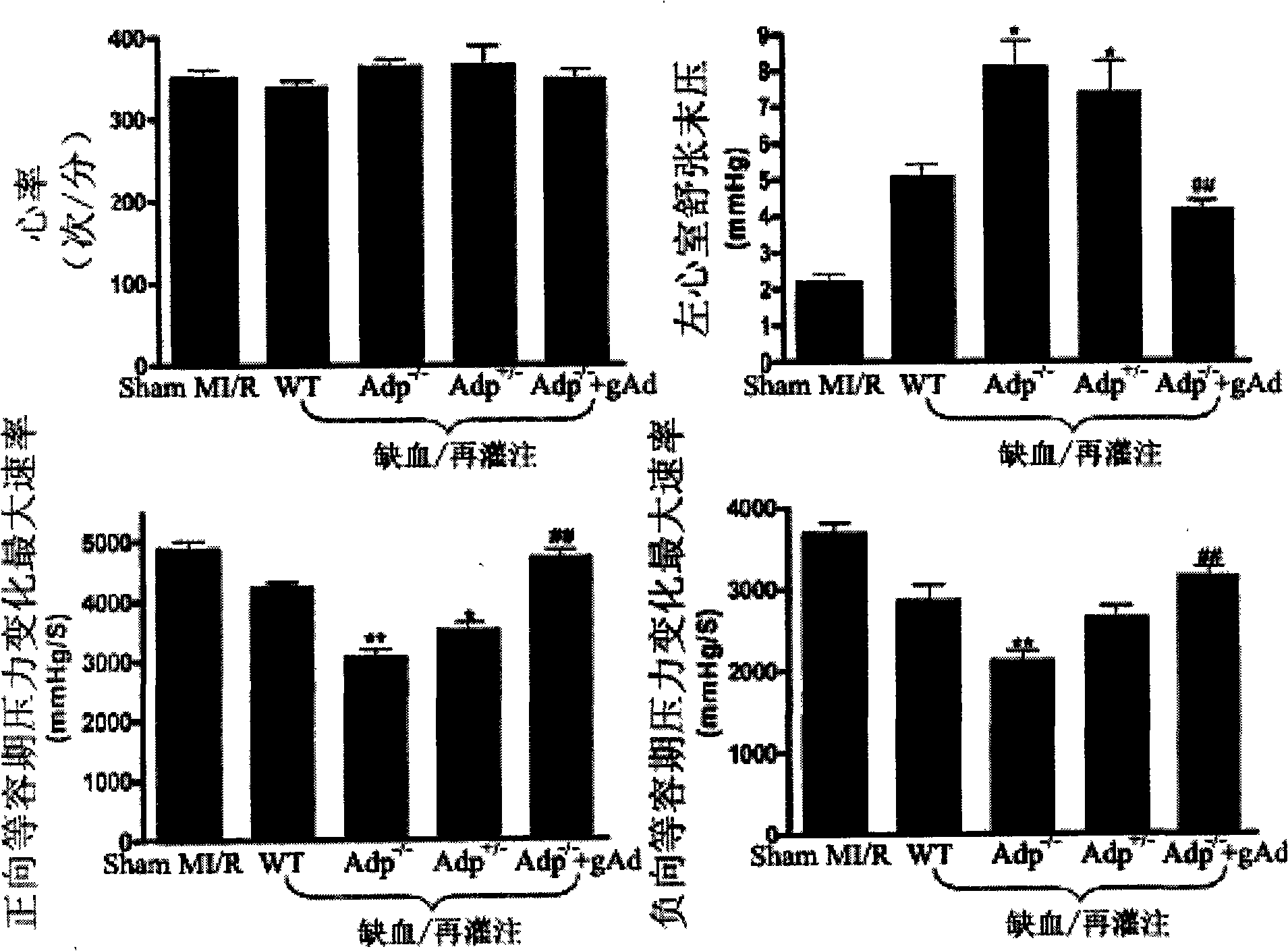 Use of human-source adiponcetin globular segment for medicine for treating diabetes and ischemic heart disease