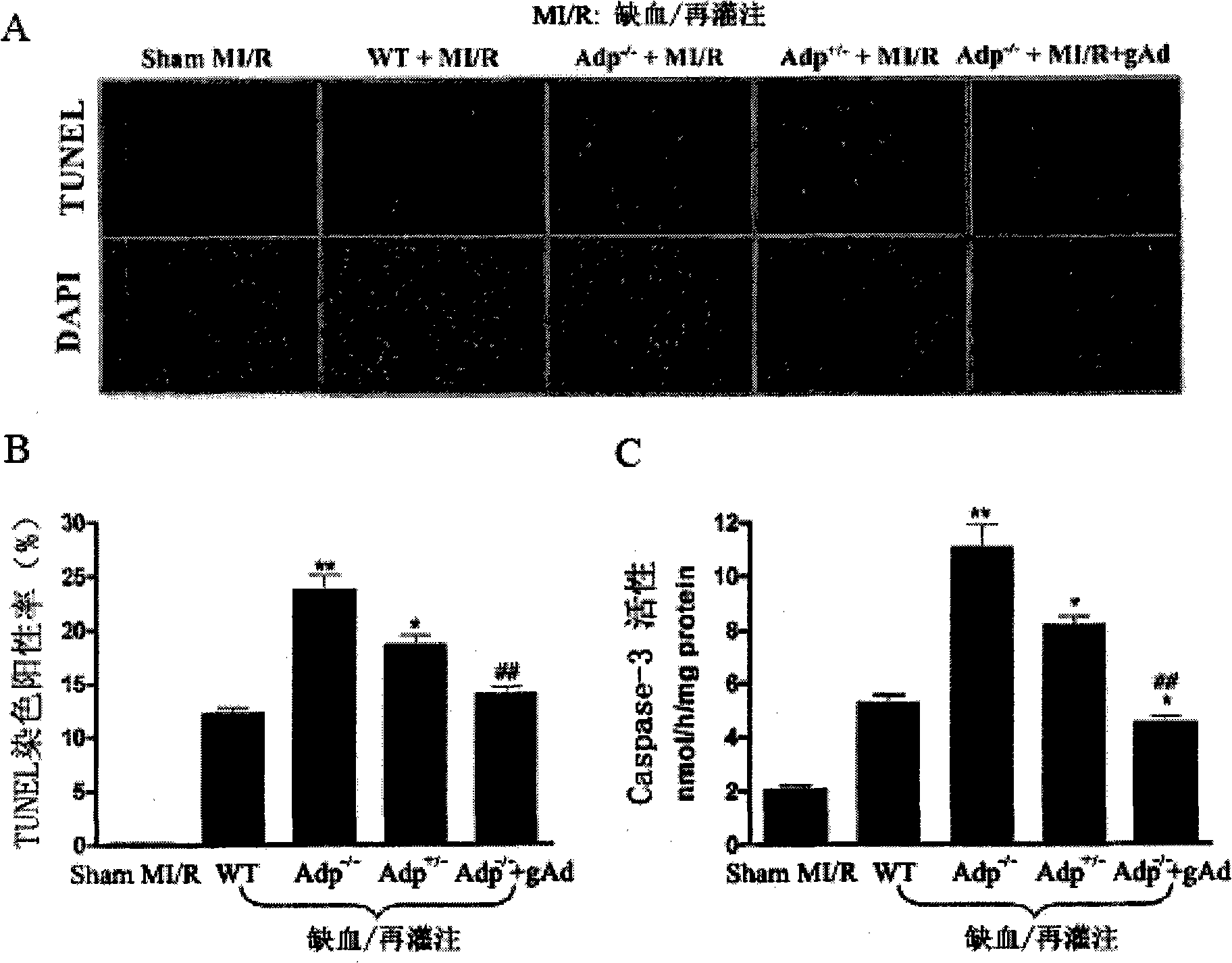 Use of human-source adiponcetin globular segment for medicine for treating diabetes and ischemic heart disease