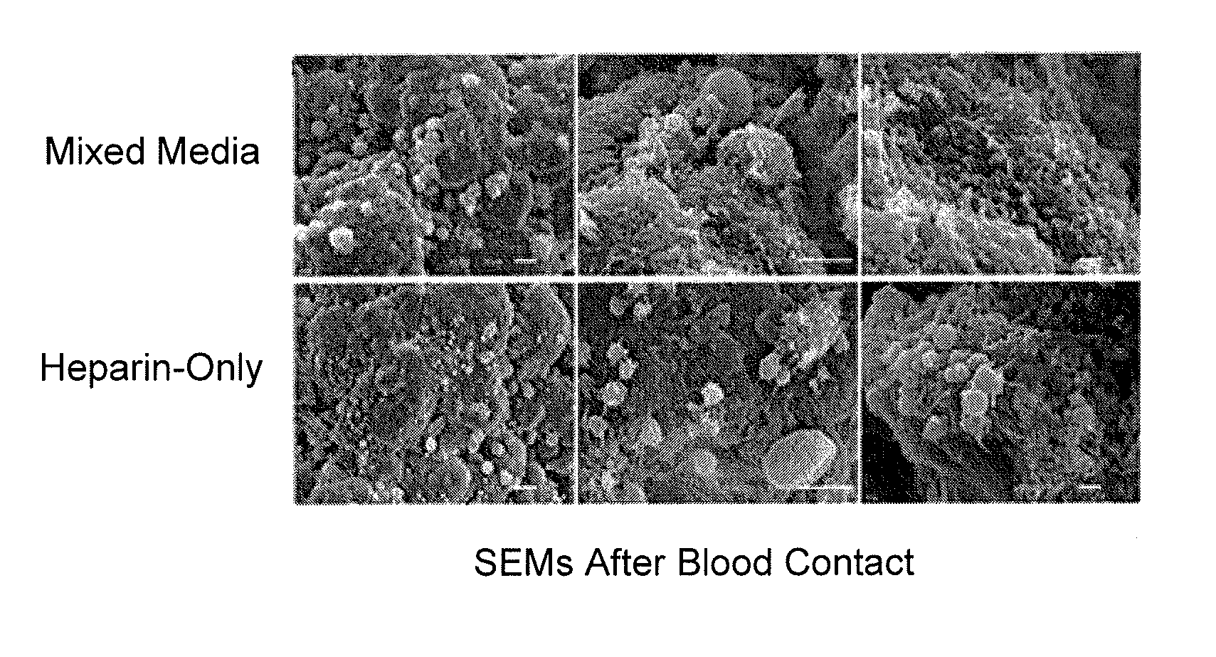 Blood filtration system containing mannose coated substrate