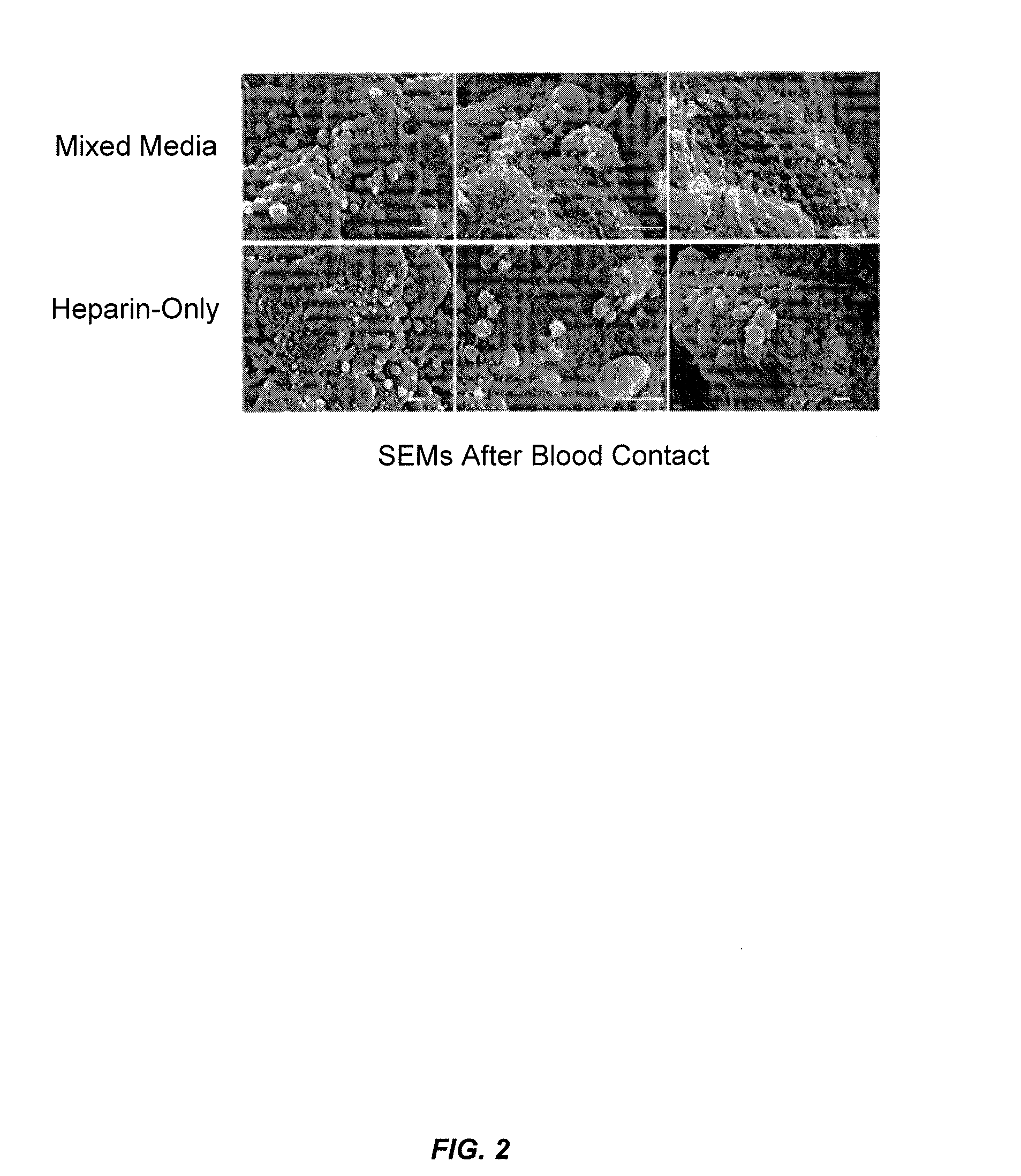 Blood filtration system containing mannose coated substrate