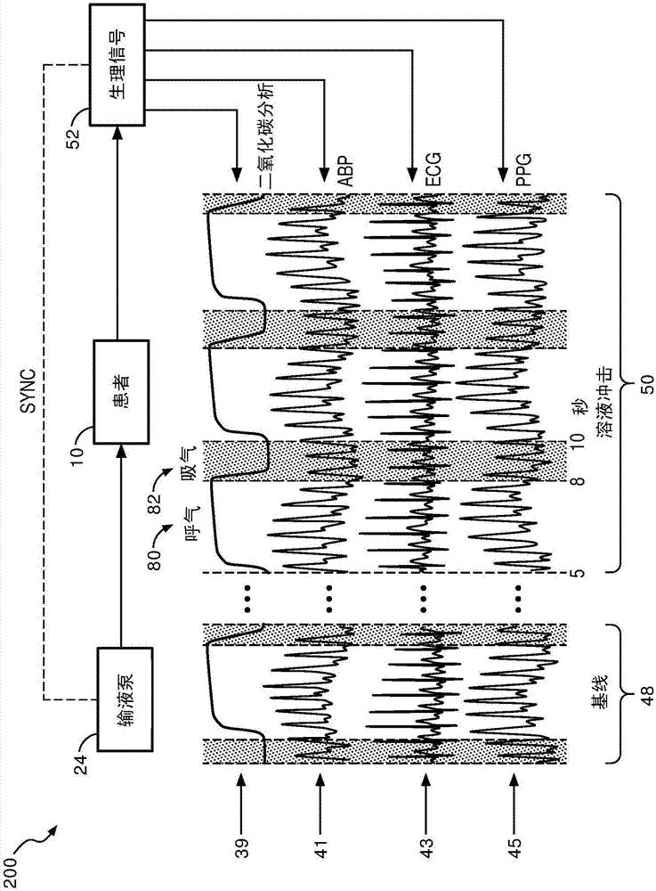 Method and system for assessing fluid responsiveness using multimodal data