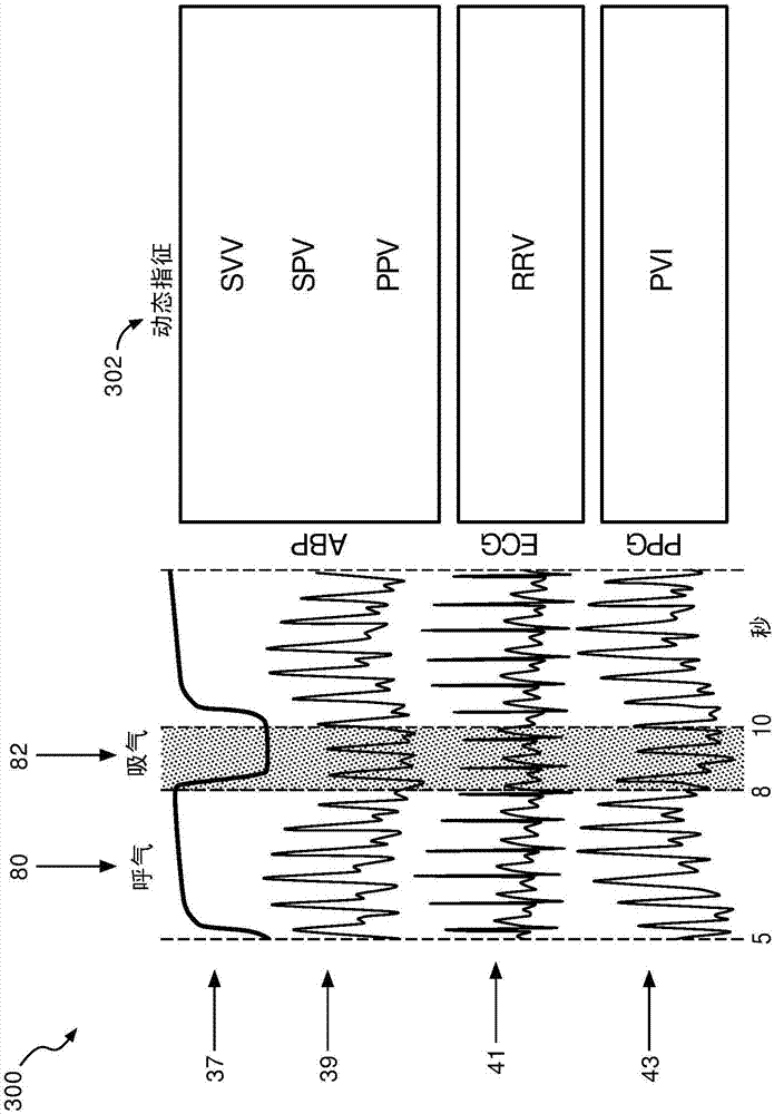 Method and system for assessing fluid responsiveness using multimodal data