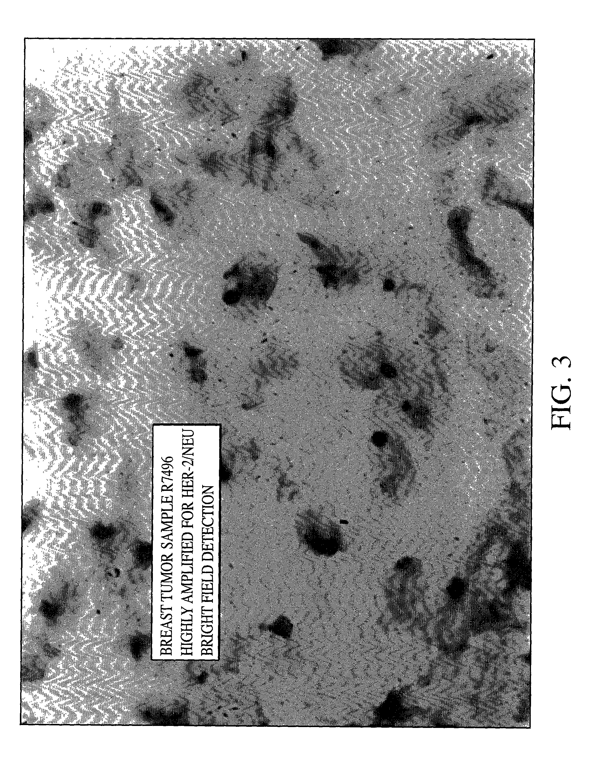 Method of detecting single gene copies in-situ