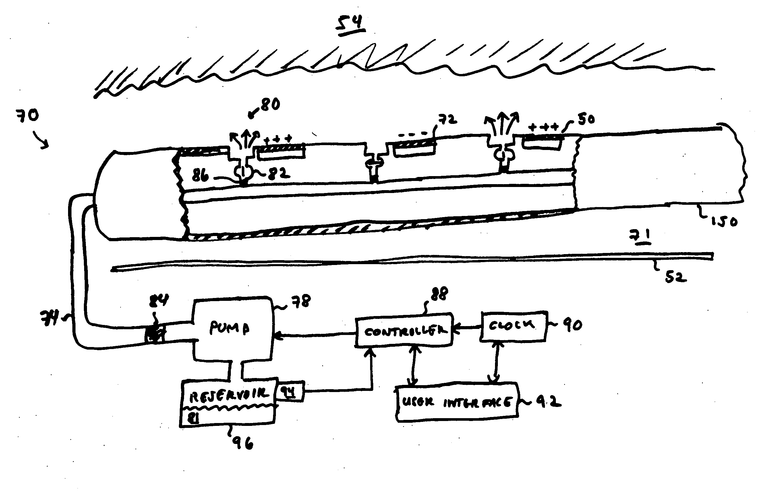 Cochlear implant with localized fluid transport