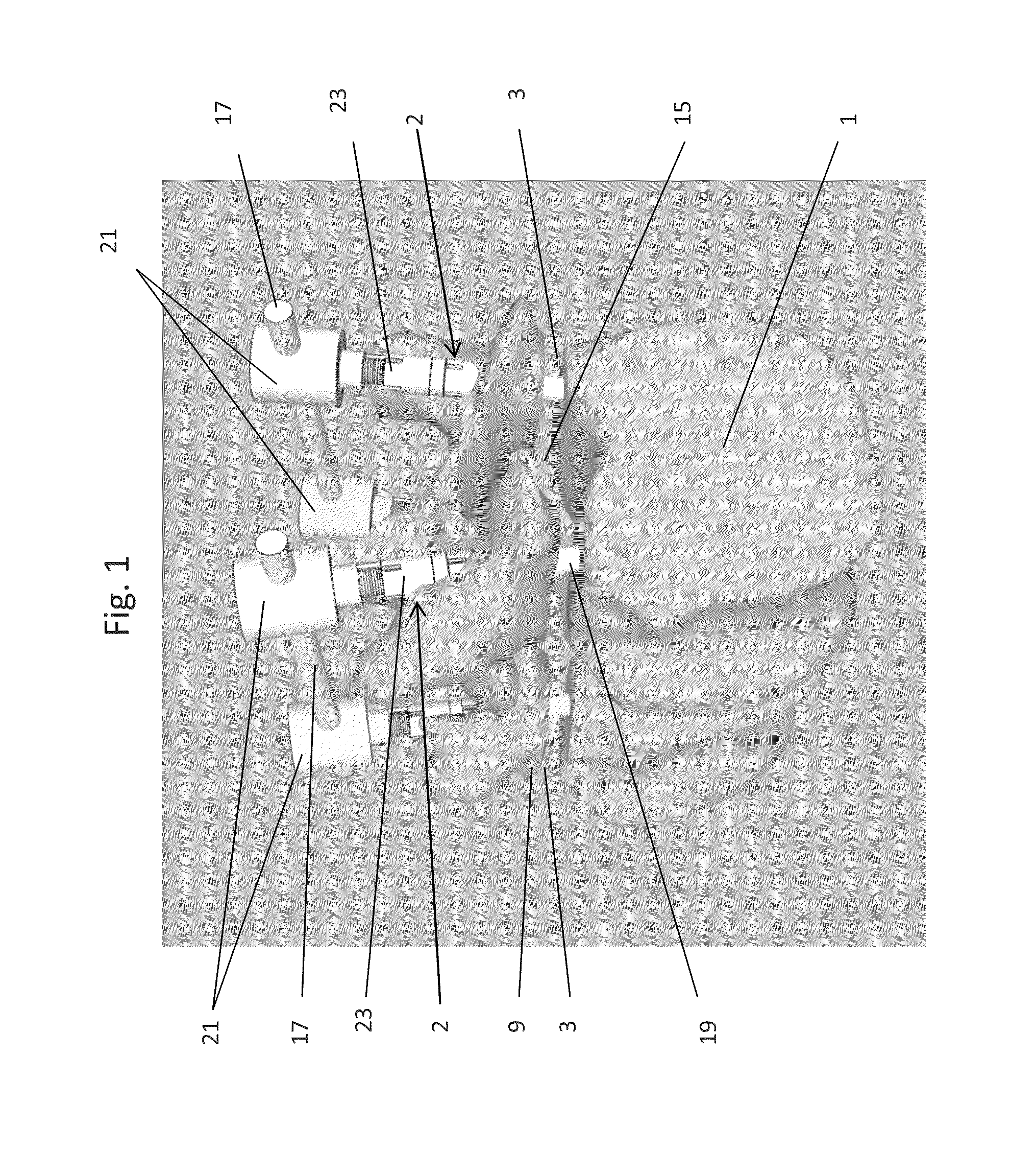 Device and method for expanding the spinal canal with spinal column stabilization and spinal deformity correction