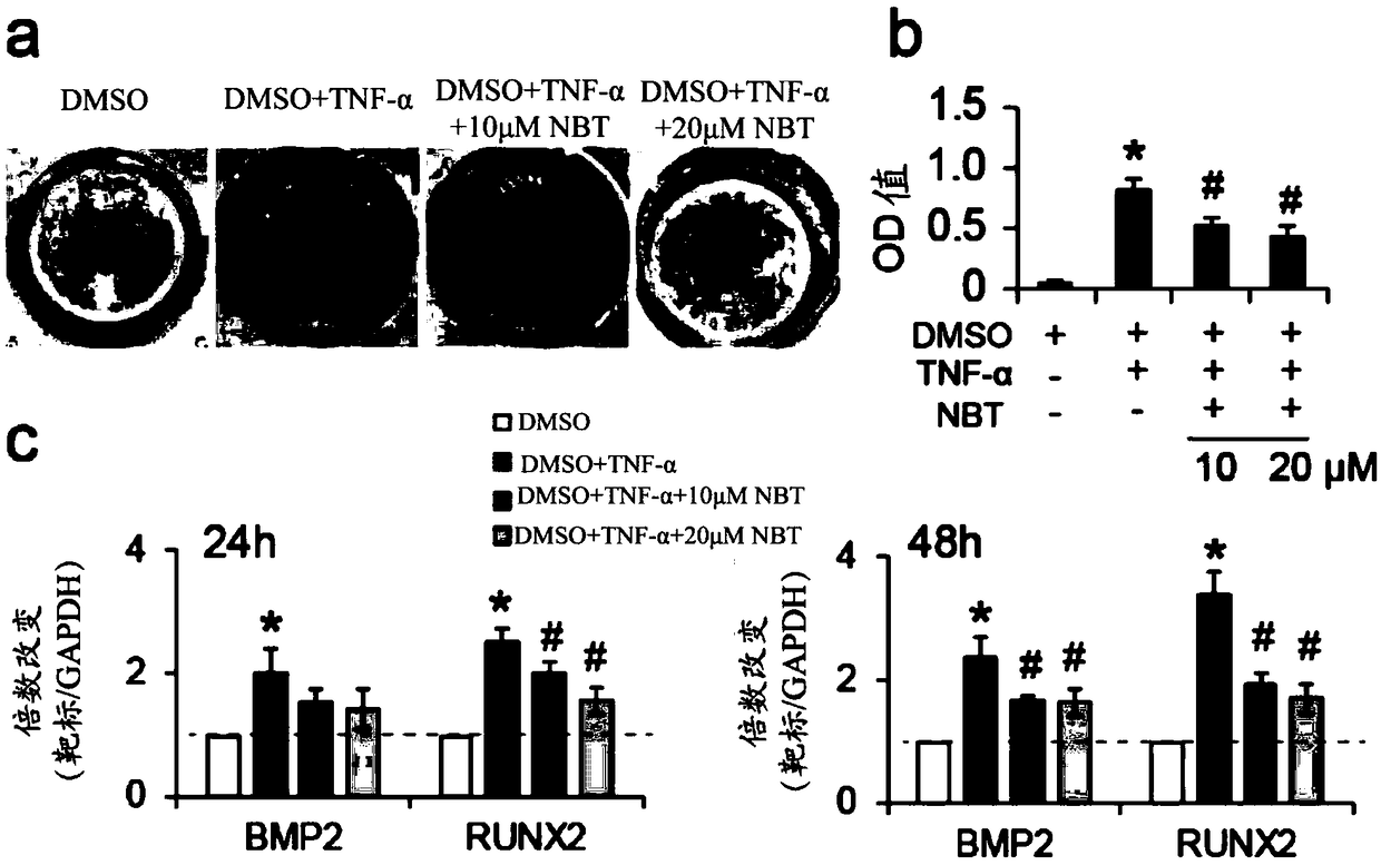 Use of nobiletin in treatment of calcific aortic valvular disease