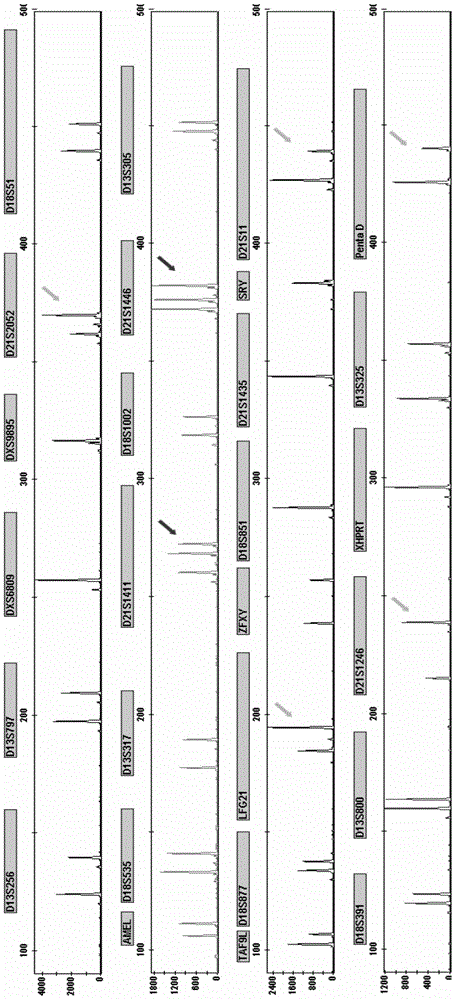 Amplification composition for detecting abnormal number of chromosomal aneuploid and rapid detection kit