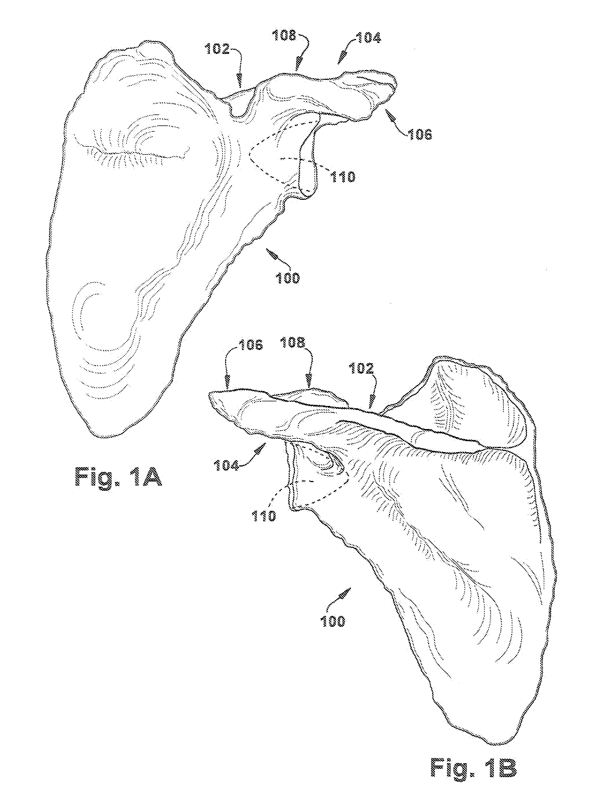 Method and apparatus for preparing for a surgical procedure