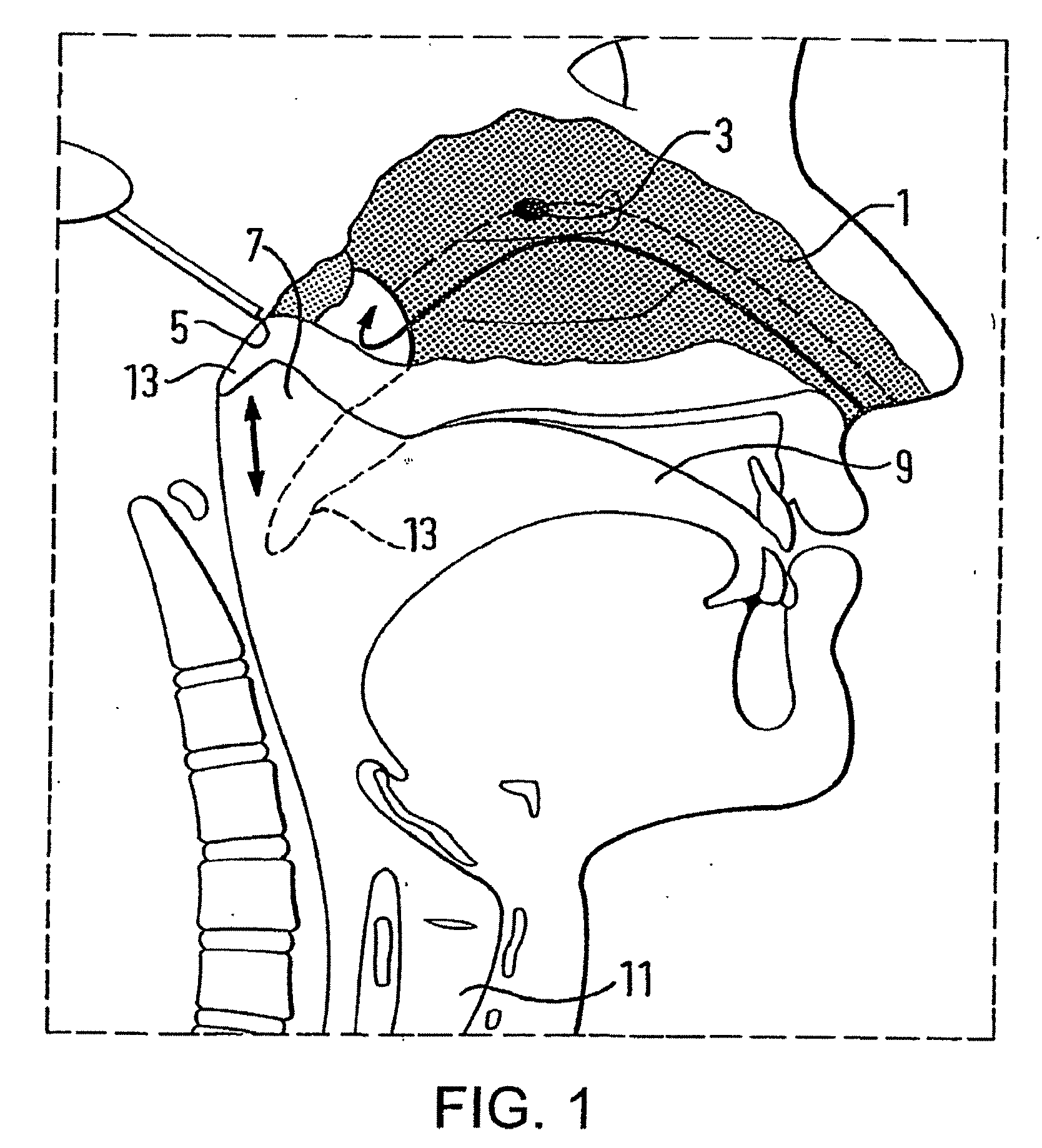 Nasal Delivery Devices