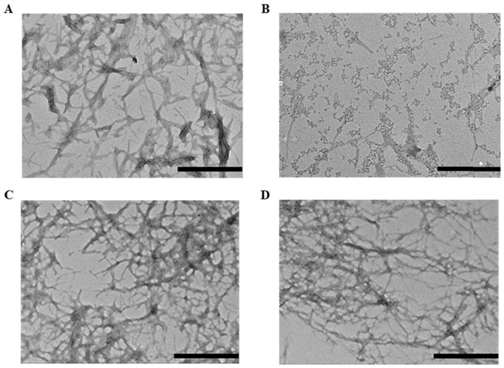 Application of beta-hydroxypyruvic acid in preparation of human islet amyloid polypeptide aggregation inhibitor