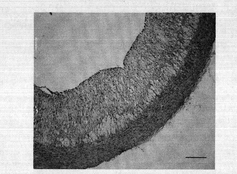 Drug combination containing raloxifene and application thereof