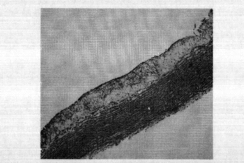 Drug combination containing raloxifene and application thereof