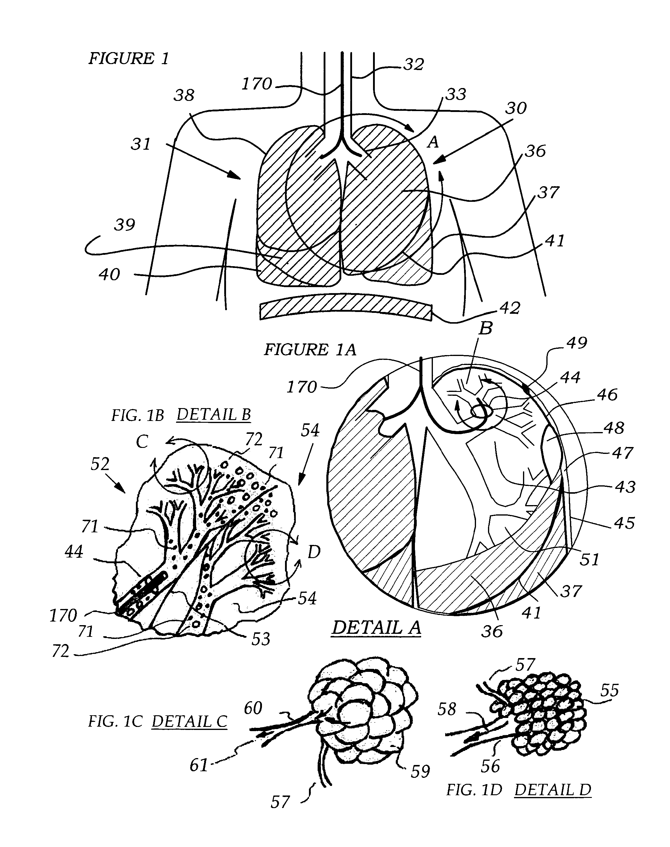 Methods, systems and devices for improving ventilation in a lung area