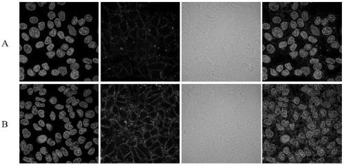 N-azido acetyl-D-mannosamine derivative, preparation method thereof, and application of N-azido acetyl-D-mannosamine derivative in esterase detection