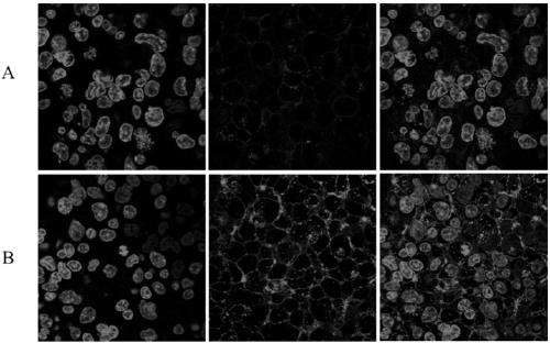 N-azido acetyl-D-mannosamine derivative, preparation method thereof, and application of N-azido acetyl-D-mannosamine derivative in esterase detection