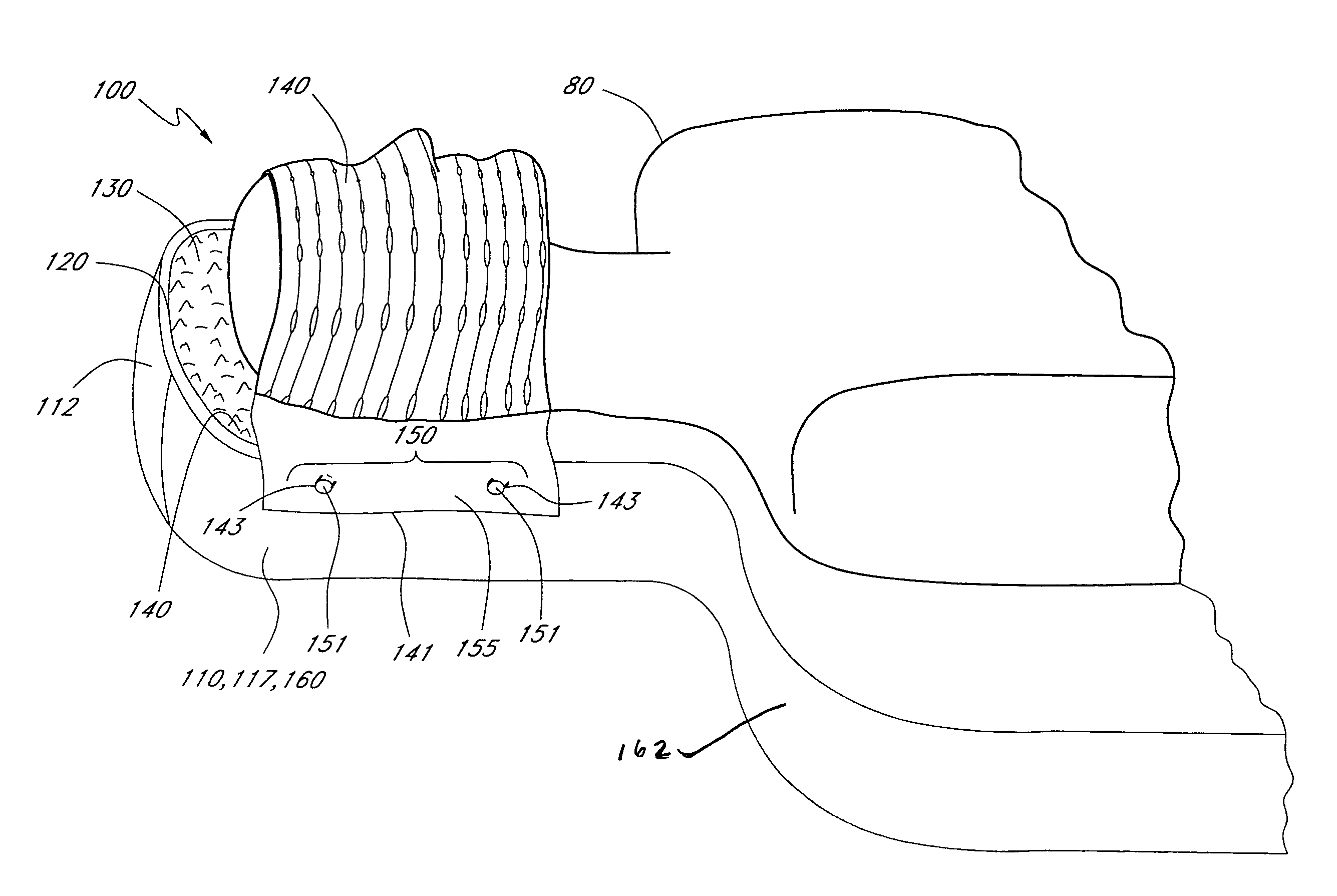 Method and device for registration and immobilization