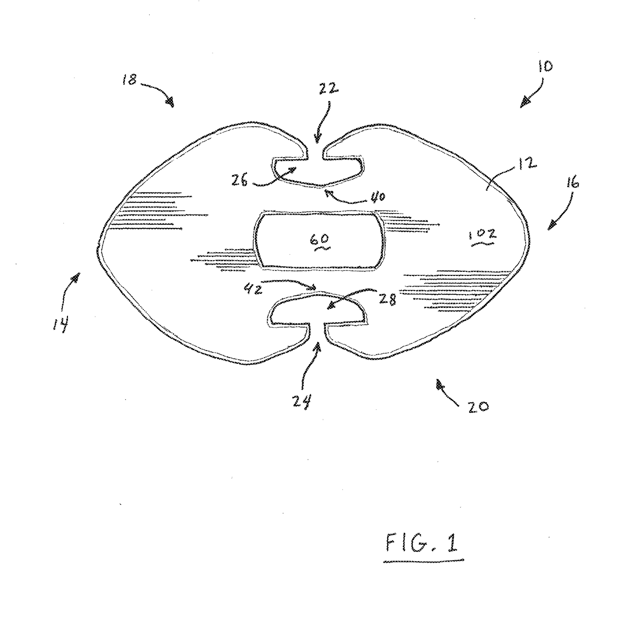 Suture button construct for surgical procedures