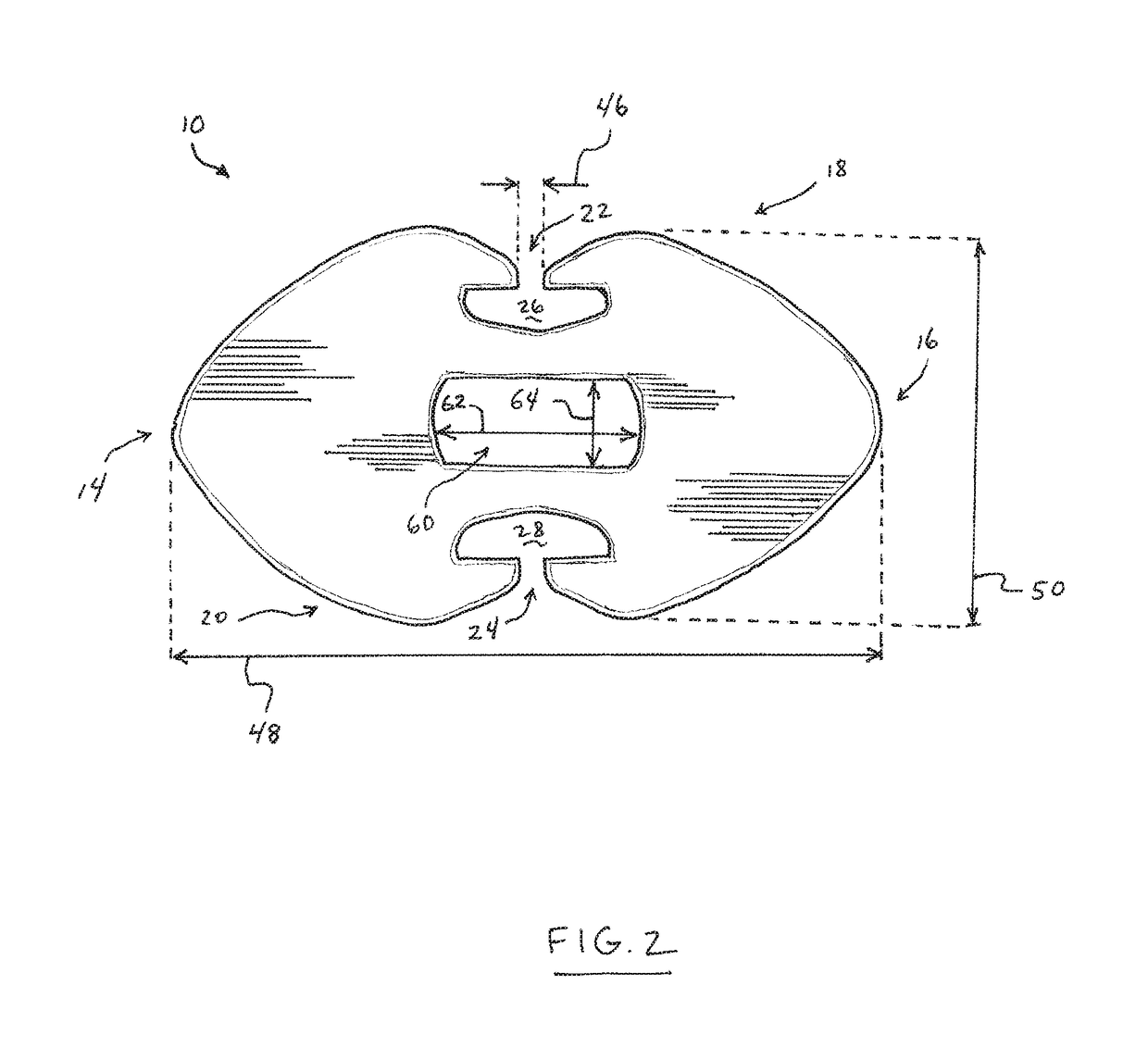 Suture button construct for surgical procedures