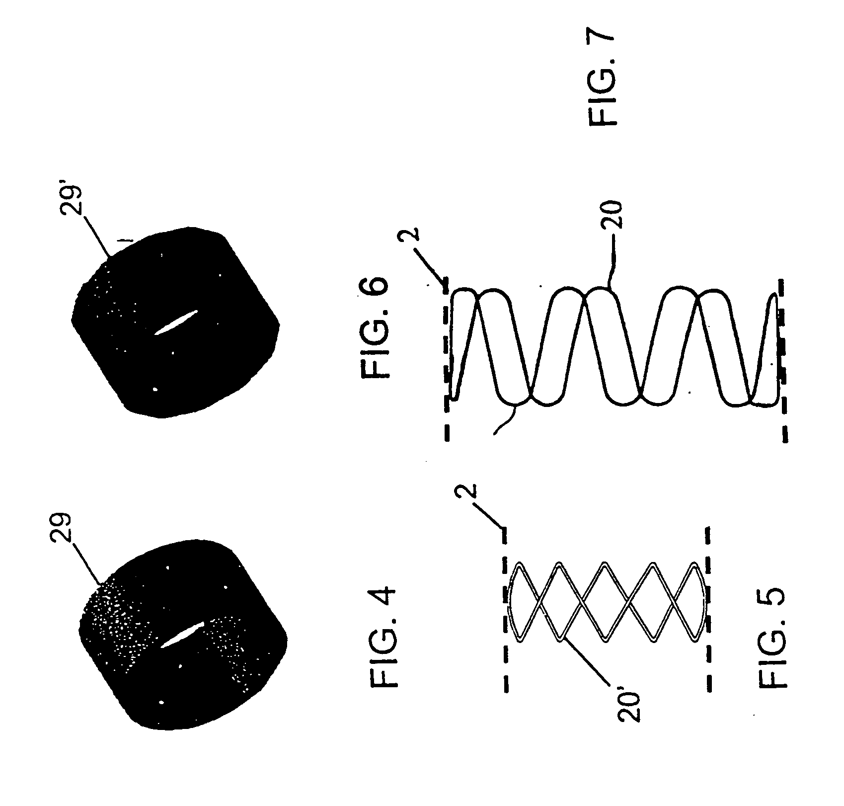 Two-part expanding stent graft delivery system