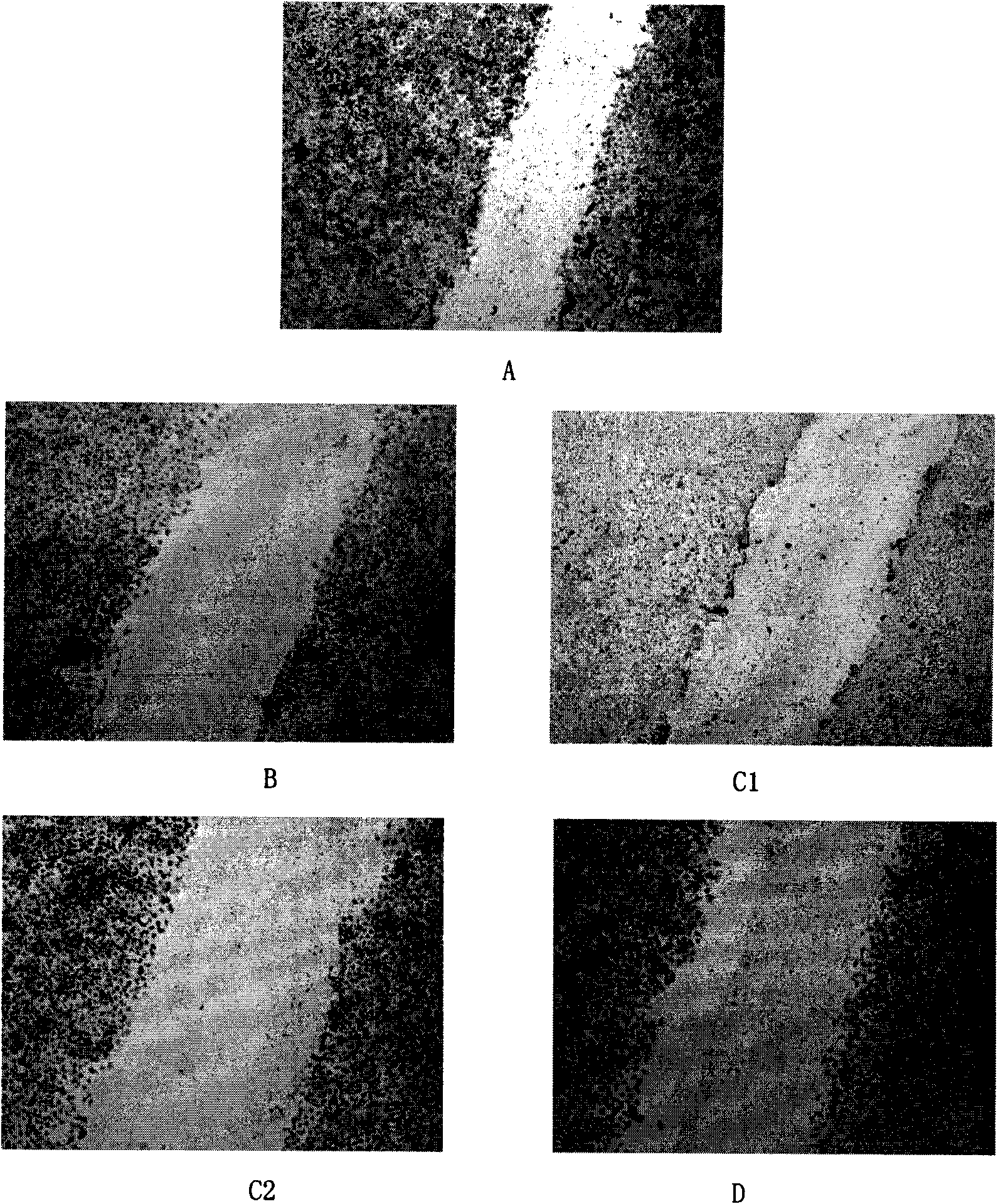 Application of icaritin in preparation of anti-angiogenic medicaments