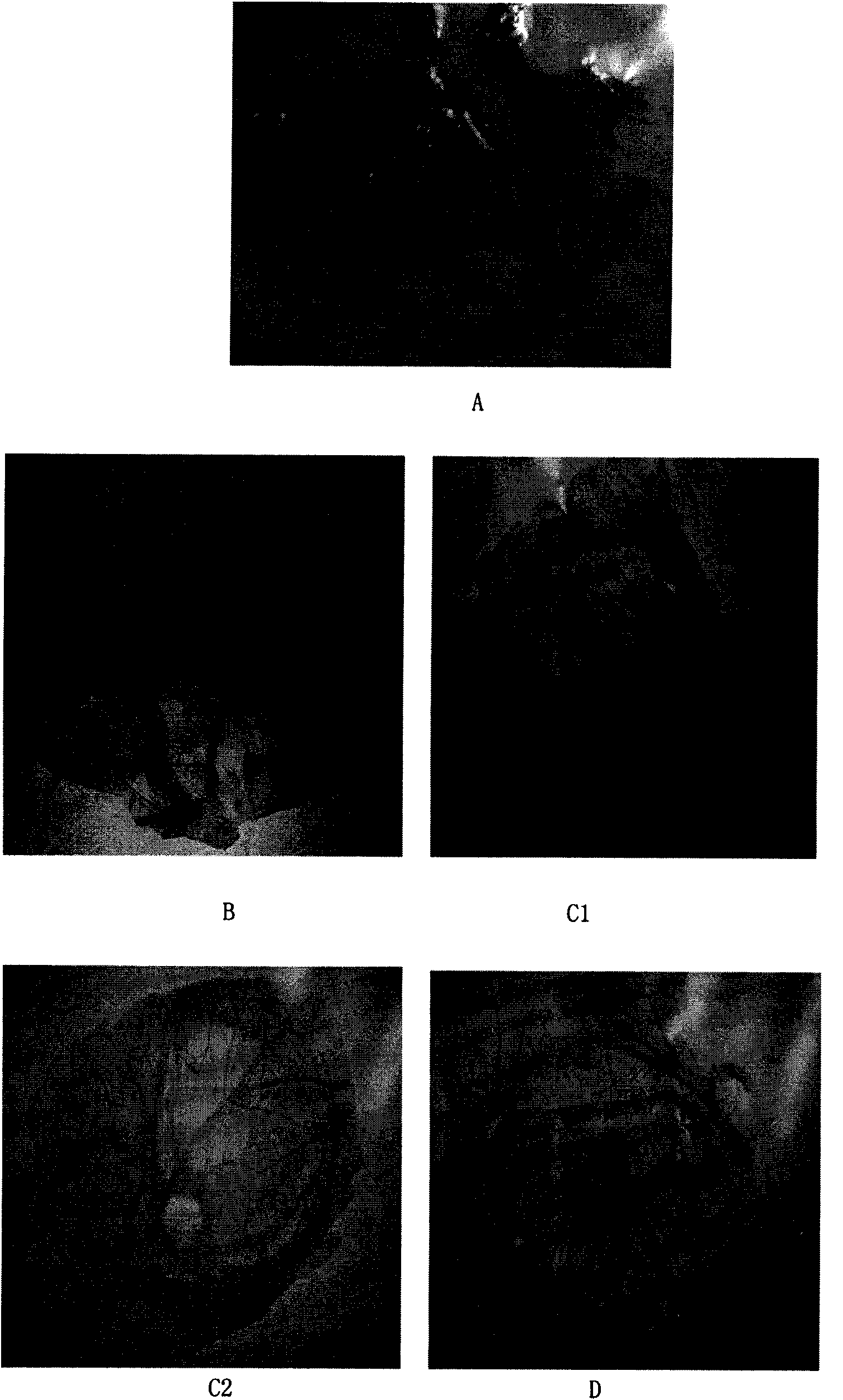 Application of icaritin in preparation of anti-angiogenic medicaments