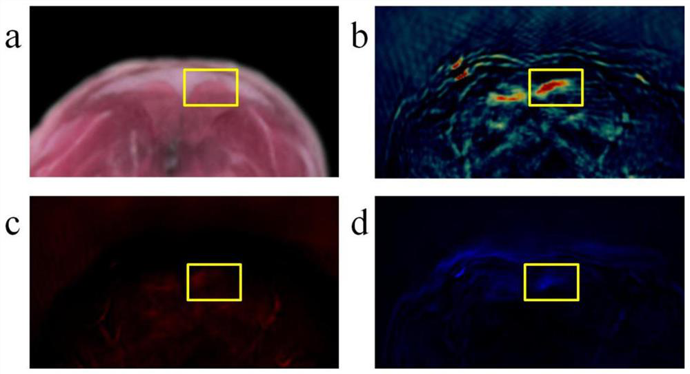 A contrast agent and its application in photoacoustic imaging of brown fat