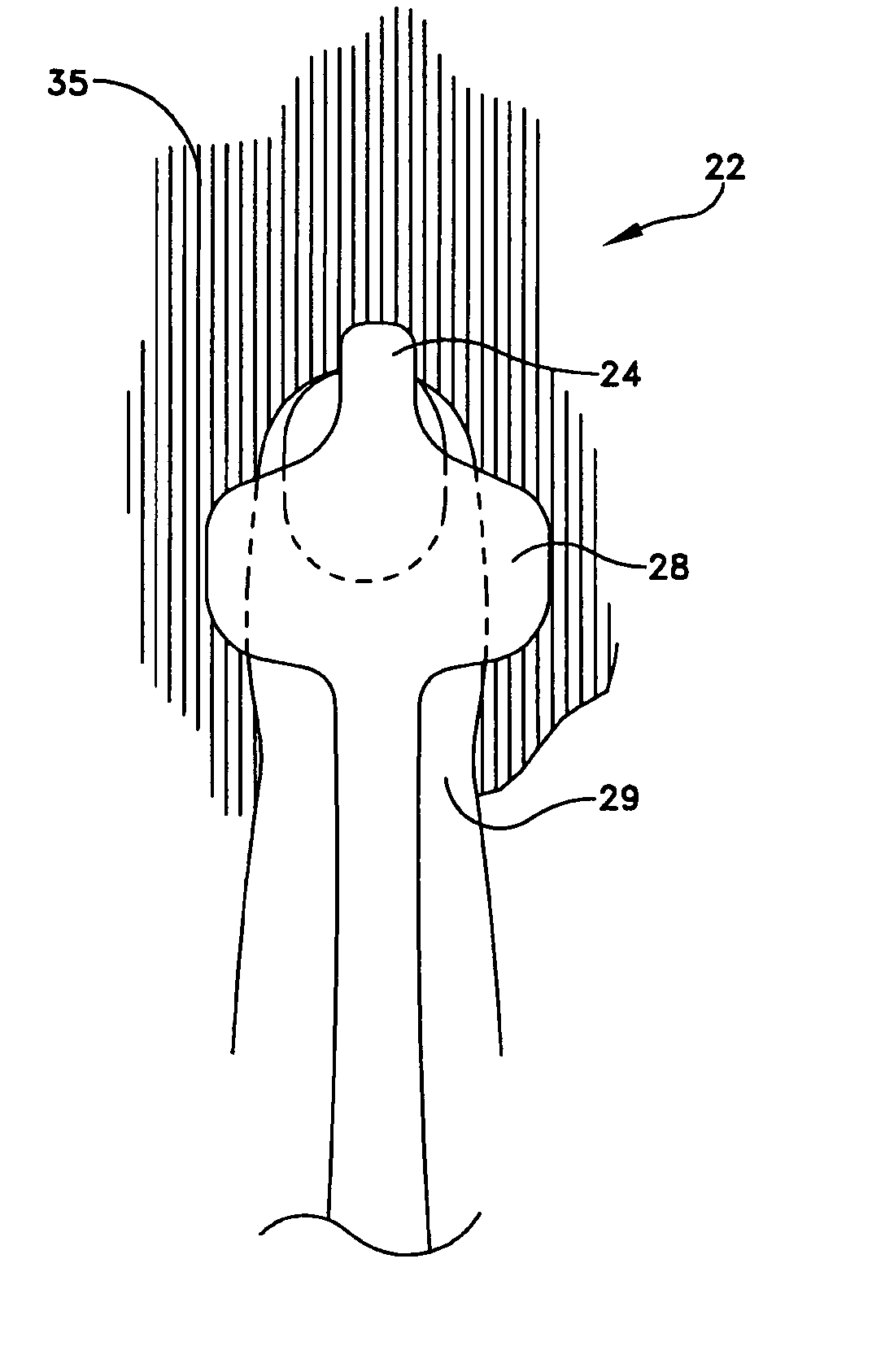 Apparatus and method for measuring the dimensions of the palpable surface of the prostate