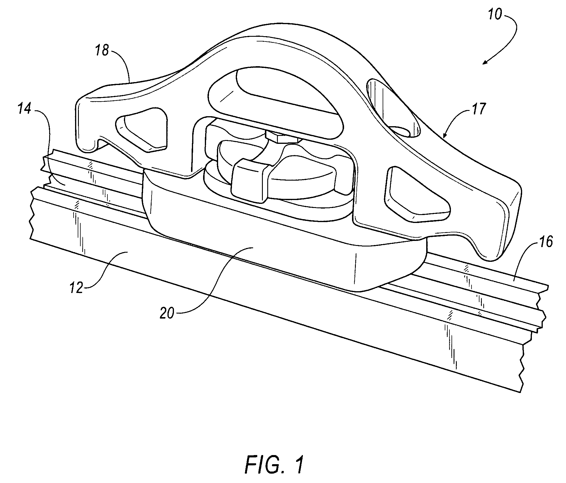 Securement mechanism