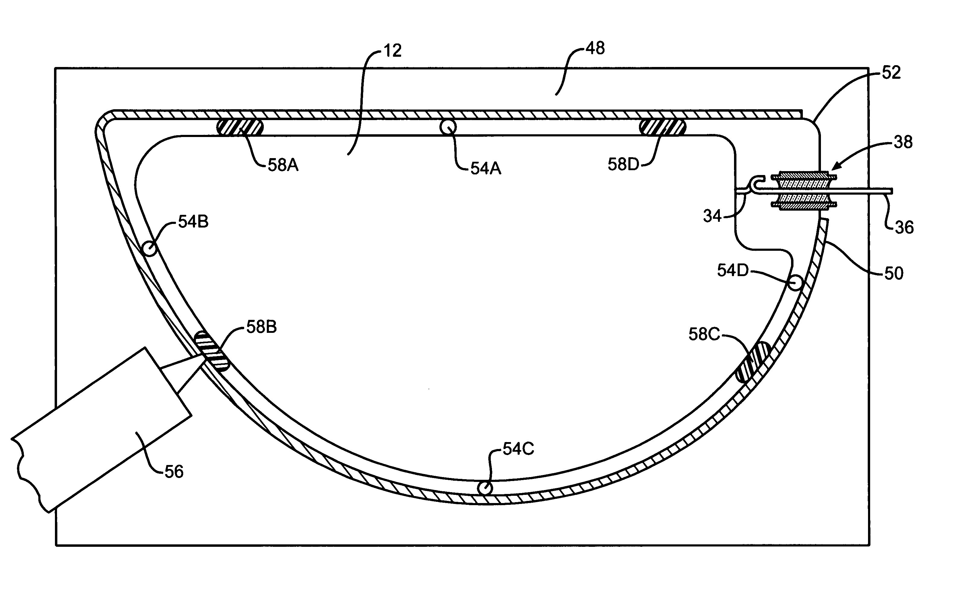 Polymeric restraints for containing an anode in an electrolytic capacitor from high shock and vibration conditions