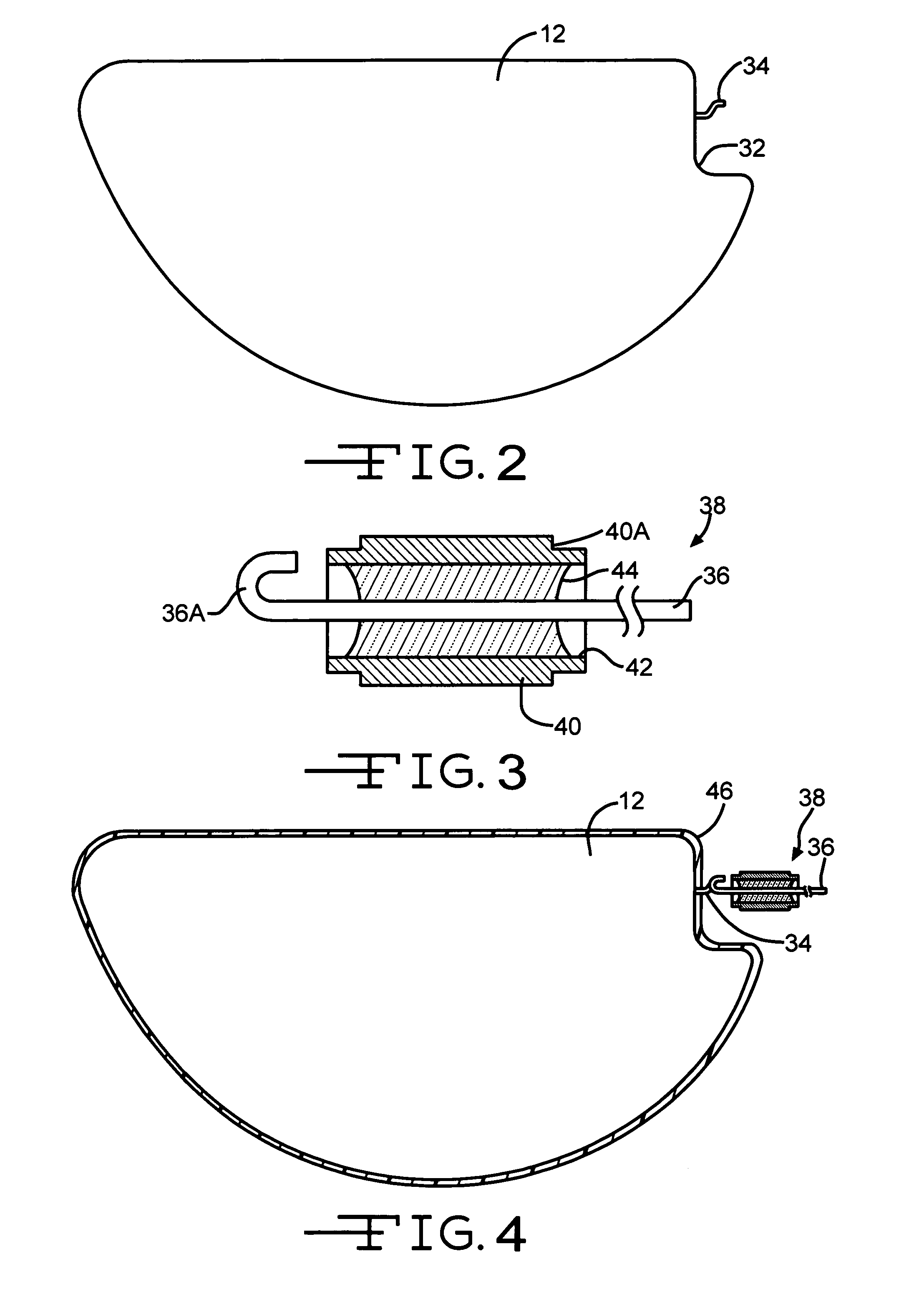 Polymeric restraints for containing an anode in an electrolytic capacitor from high shock and vibration conditions