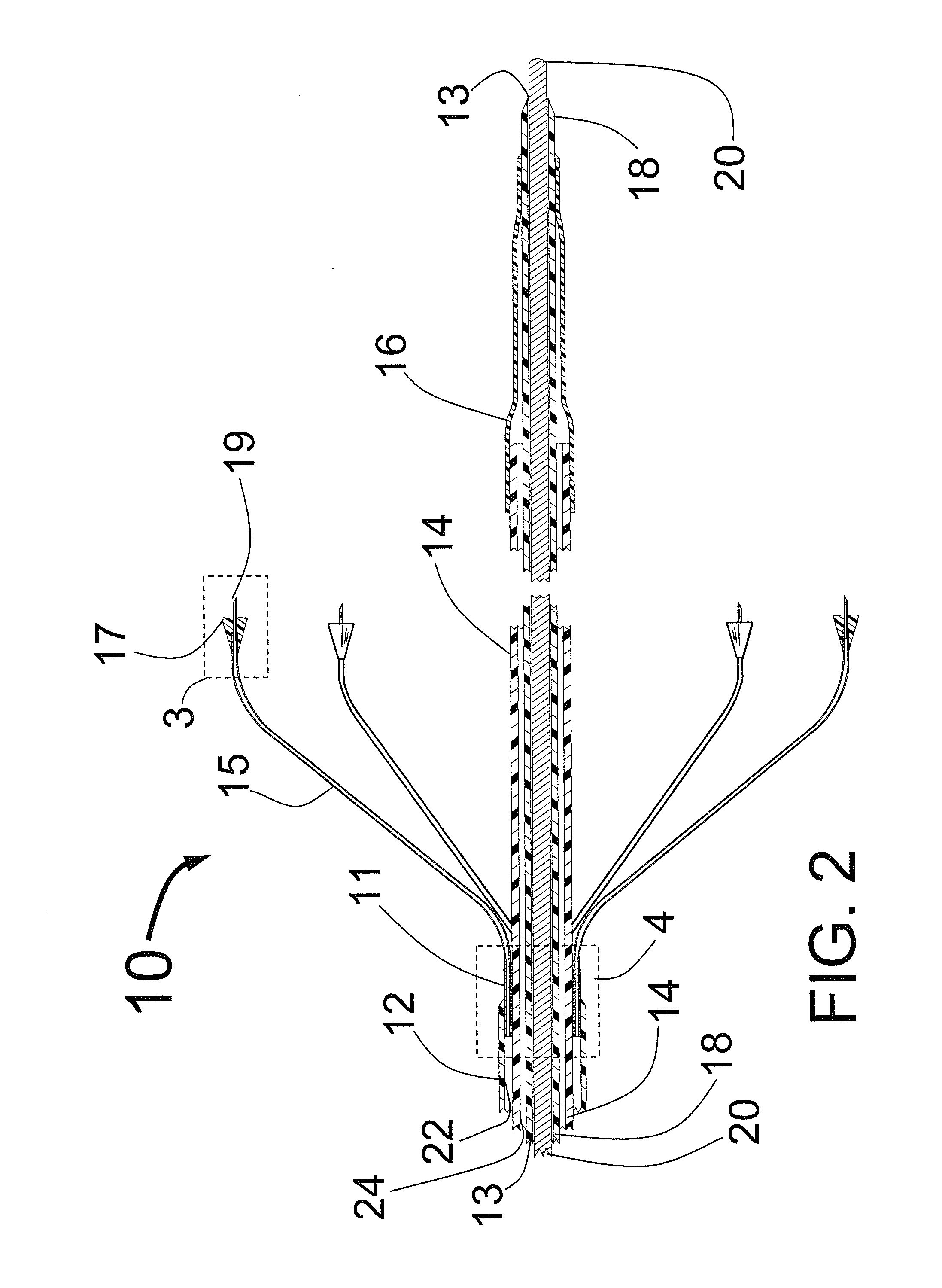 Expandable catheter system for peri-ostial injection and muscle and nerve fiber ablation