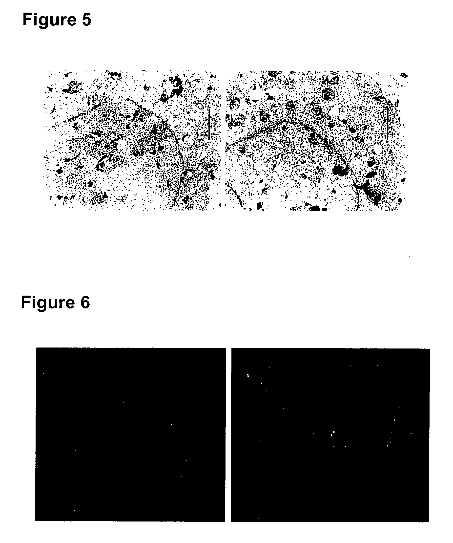 Method for ex-vivo separation of apoptotic chromatin fragments from blood or plasma for prevention and treatment of diverse human diseases