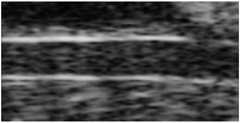 Full-automatic contrast-enhanced ultrasonic image segmentation method