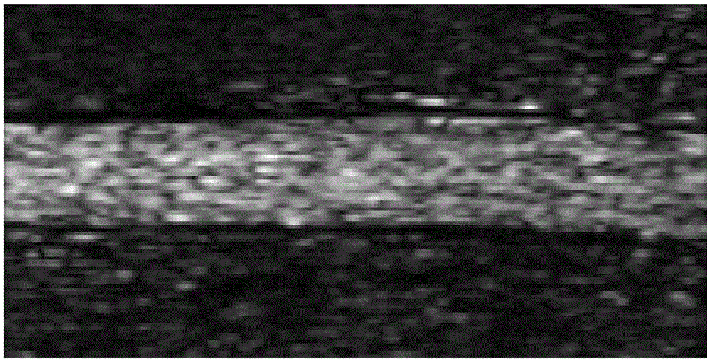 Full-automatic contrast-enhanced ultrasonic image segmentation method