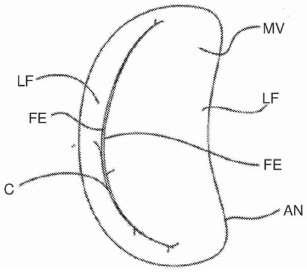 Tissue grasping device and related methods