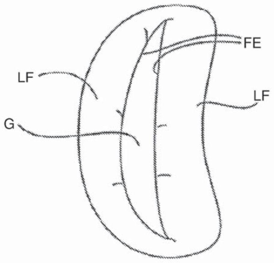 Tissue grasping device and related methods