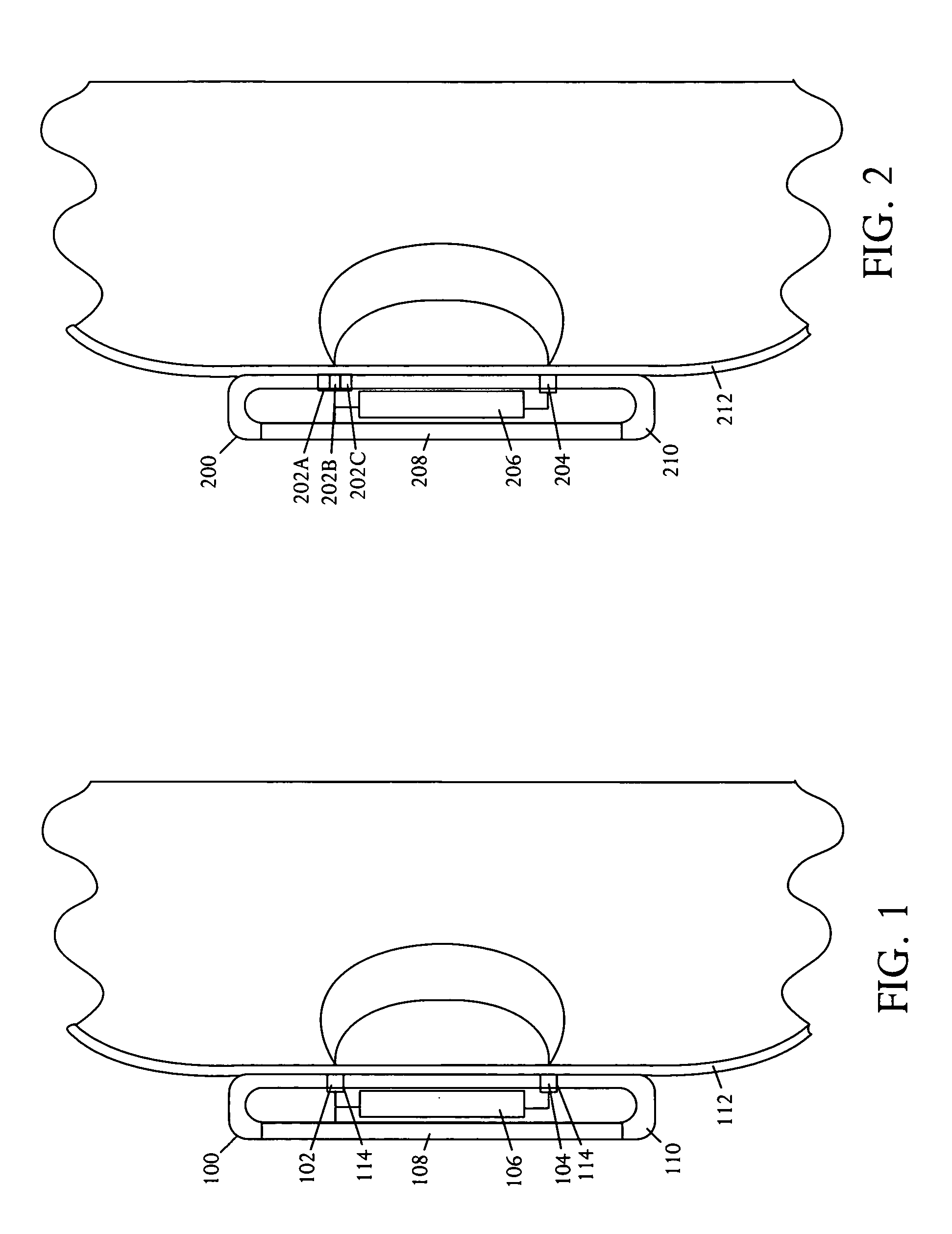 Noninvasive glucose sensor