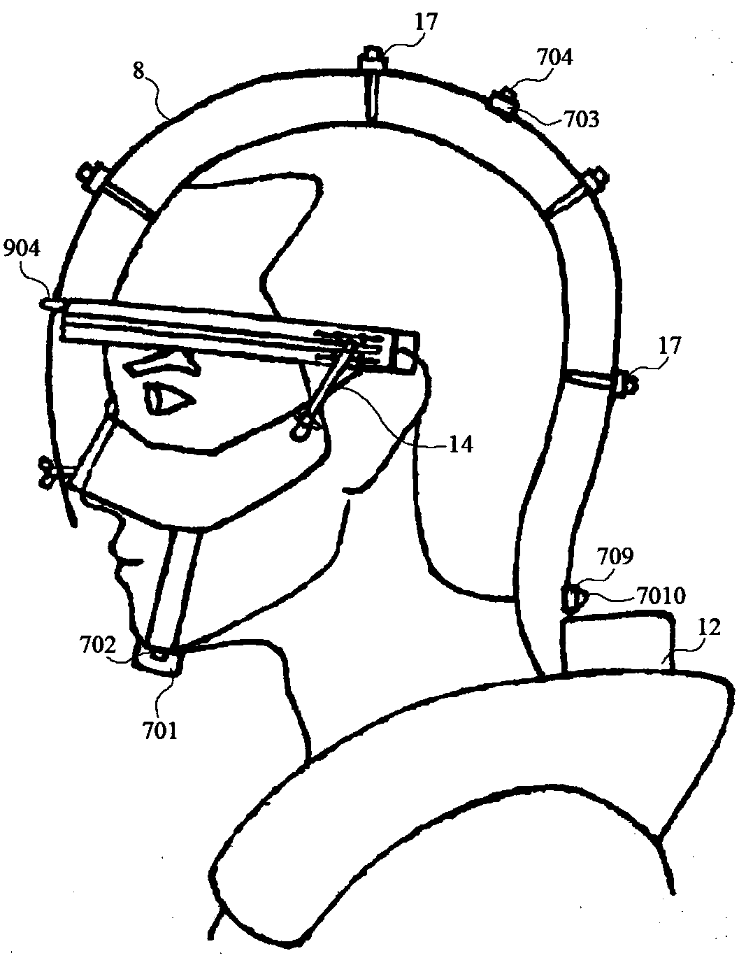 Method and device for three-dimensionally positioning heads of human bodies and modeling scalp states