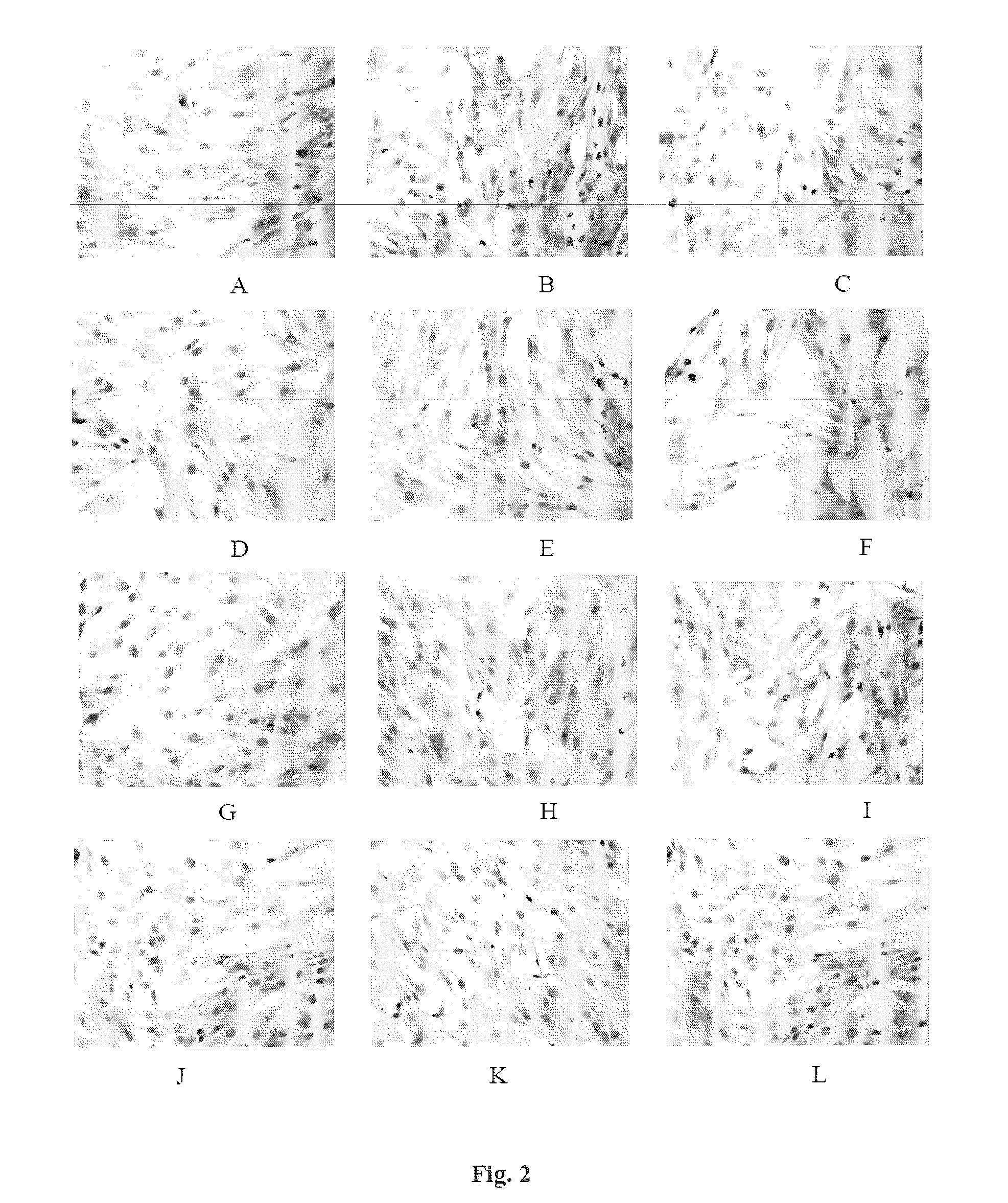 Pharmaceutical Composition For Preventing And Treating Diabetic Nephropathy And The Preparation Method Thereof