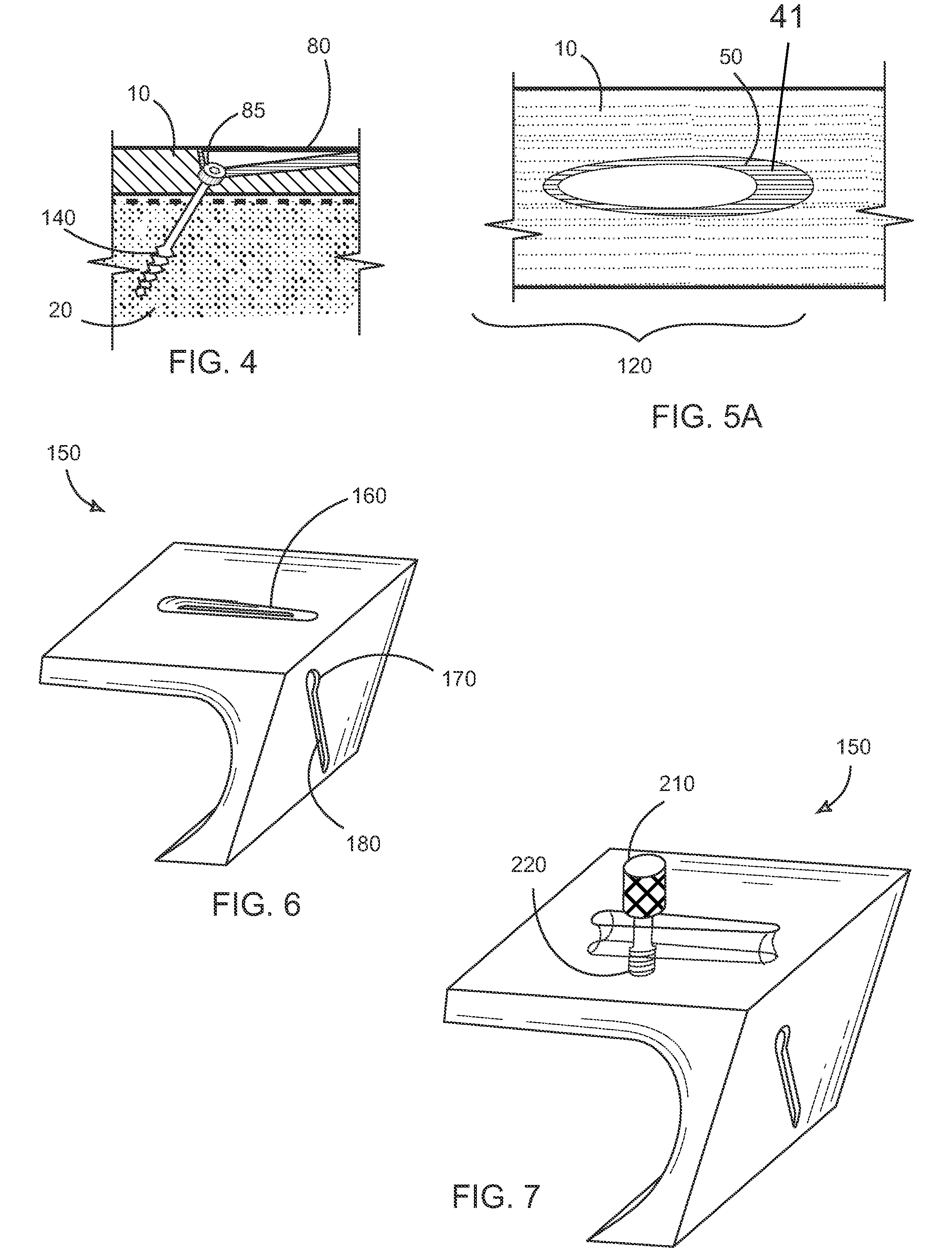 Ulnar osteotomy plate including increased compression