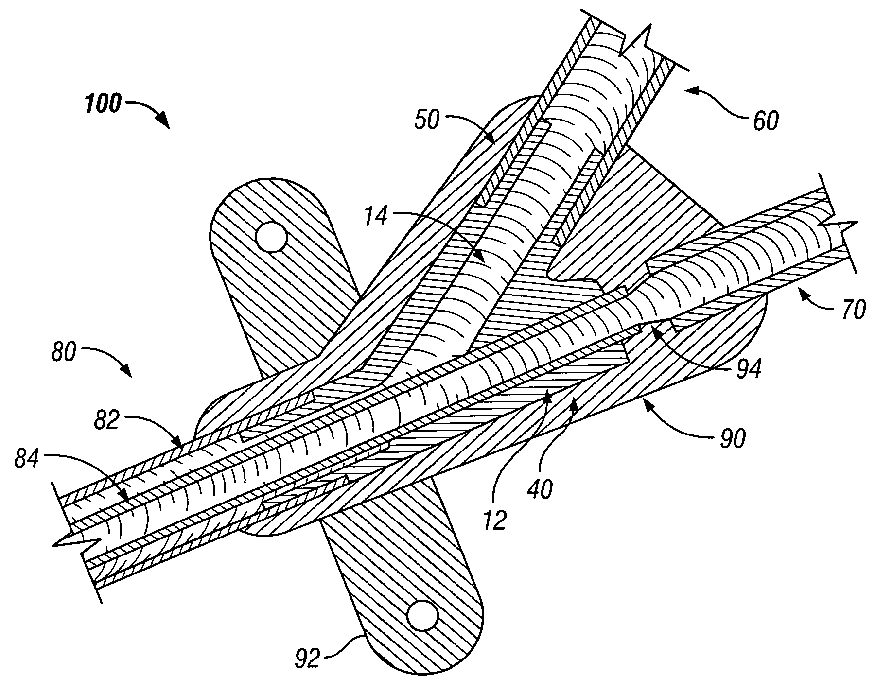 Pre-molded bifurcation insert