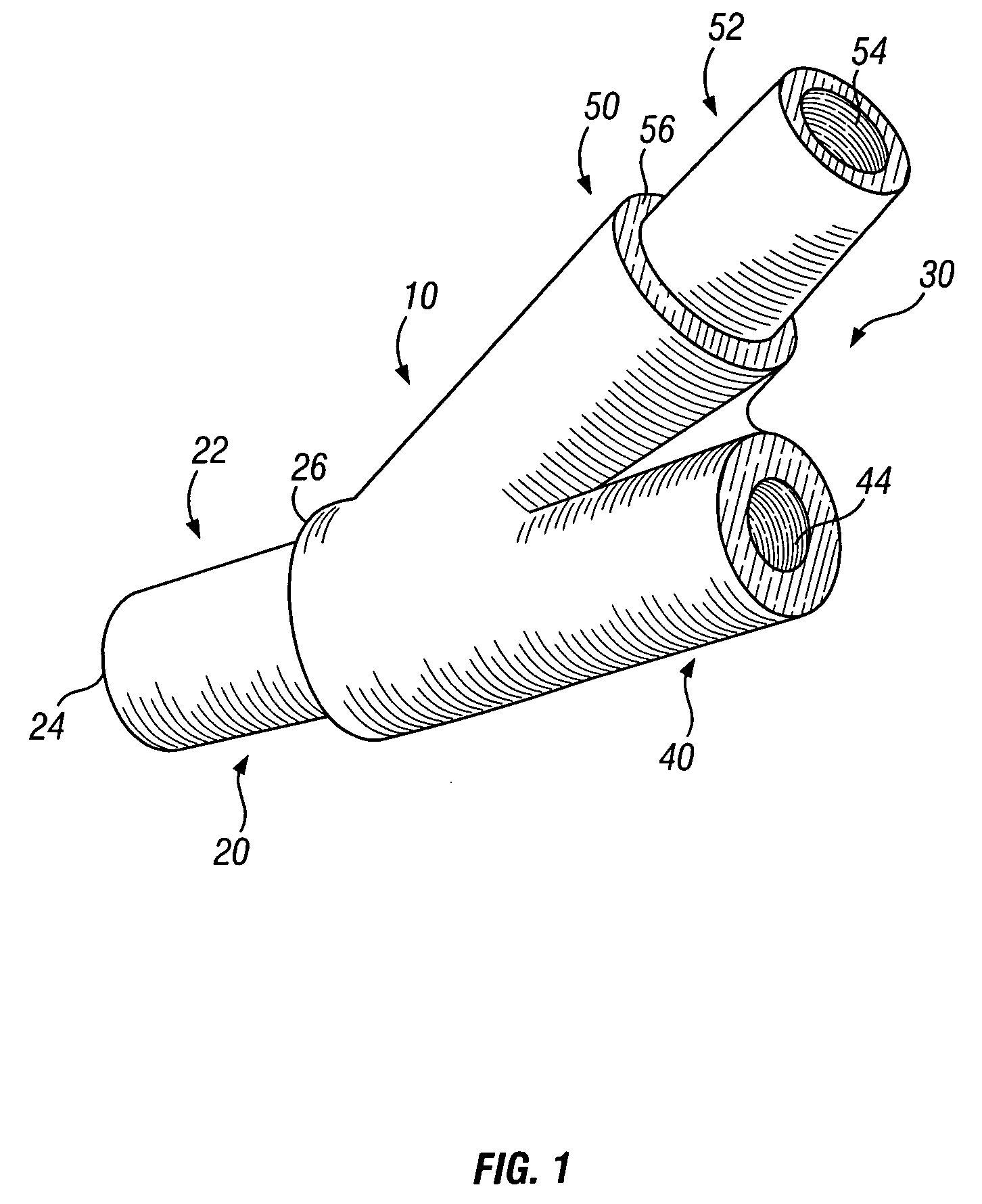 Pre-molded bifurcation insert