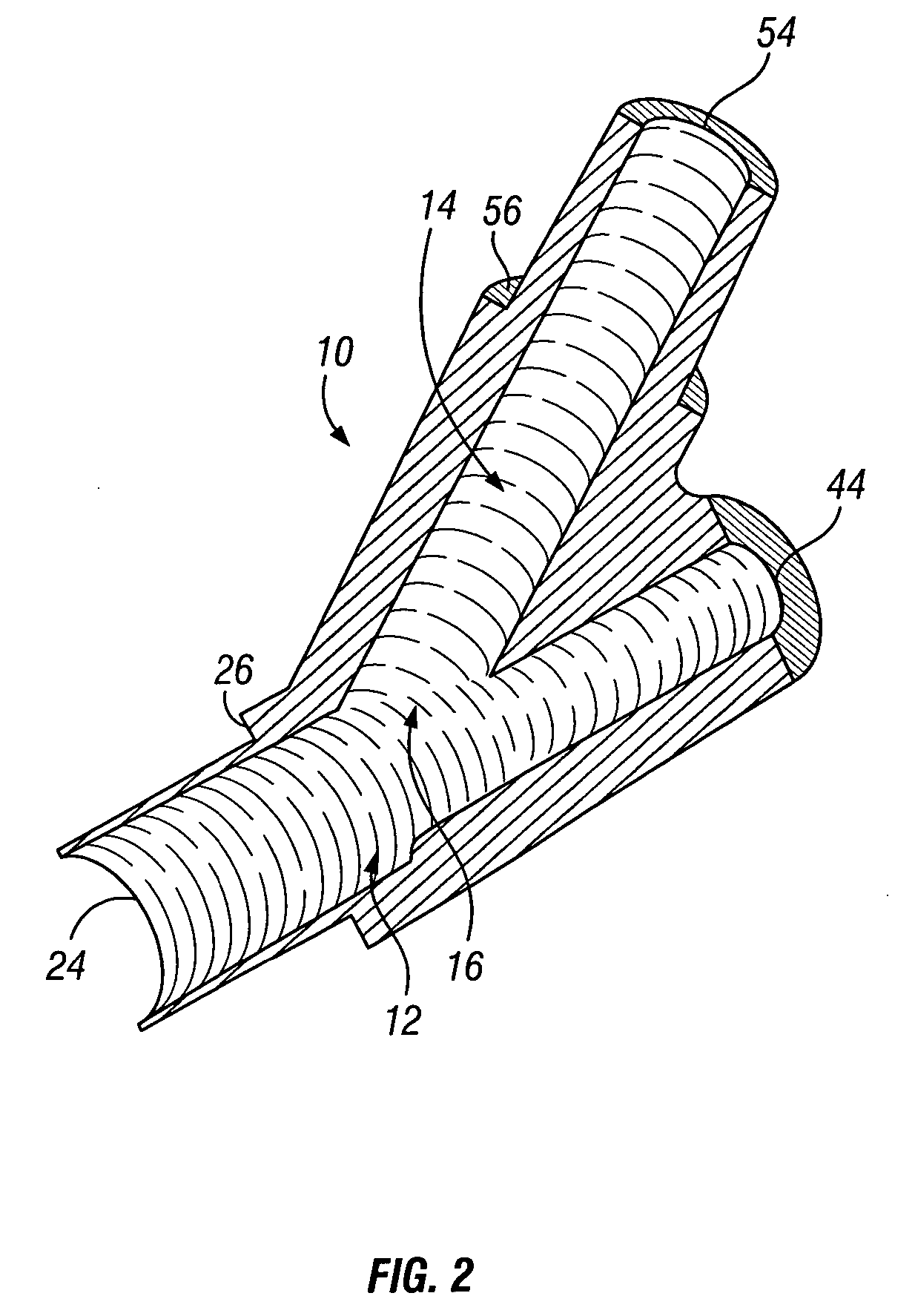 Pre-molded bifurcation insert