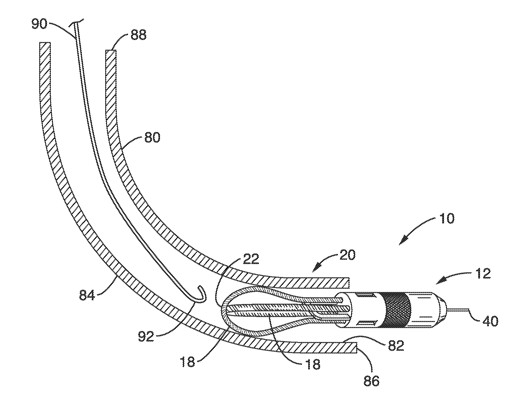 Fish tape leader with quick change coupling