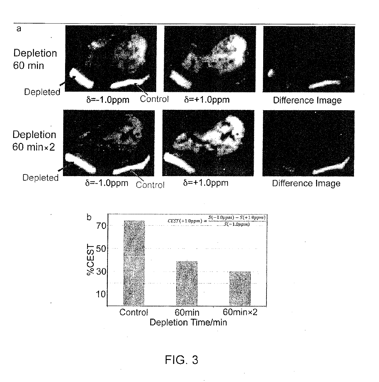 Method, system, and computer-accessible medium for assessment of glycosaminoglycan concentration in vivo by chemical exchange saturation transfer