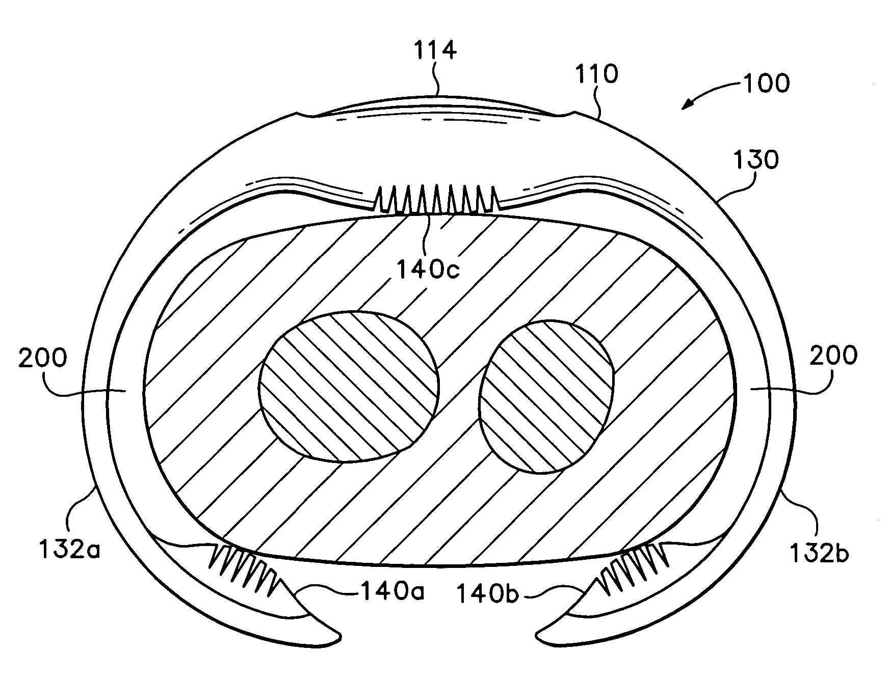 Timepiece with integral molded wristband