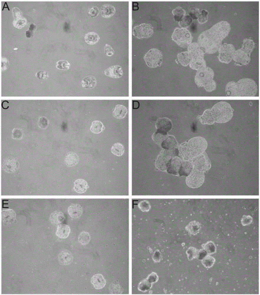 Application of ERK inhibitor PD98059 in preparation of medicine for treatment of alveolar hydatid disease